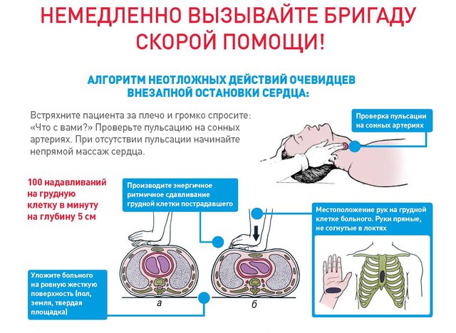 Сердечно-лёгочная реанимация: когда делать и как делать