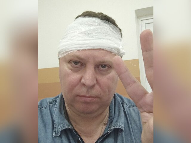 СК возбудил уголовное дело после нападения на депутата Госдумы в Самаре