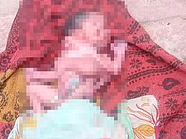 Daily Mail: младенец родился в Индии с двумя лицами и парными конечностями
