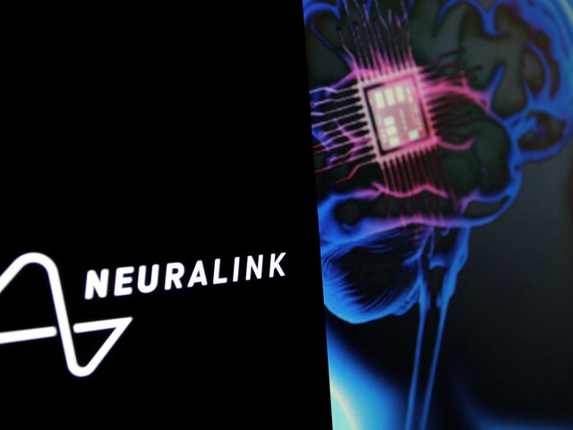 Человек с имплантом Neuralink рассказал, что пользуется им почти весь день