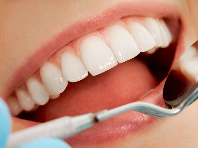 Стоматолог рассказала, как связаны проблемы с зубами и головная боль