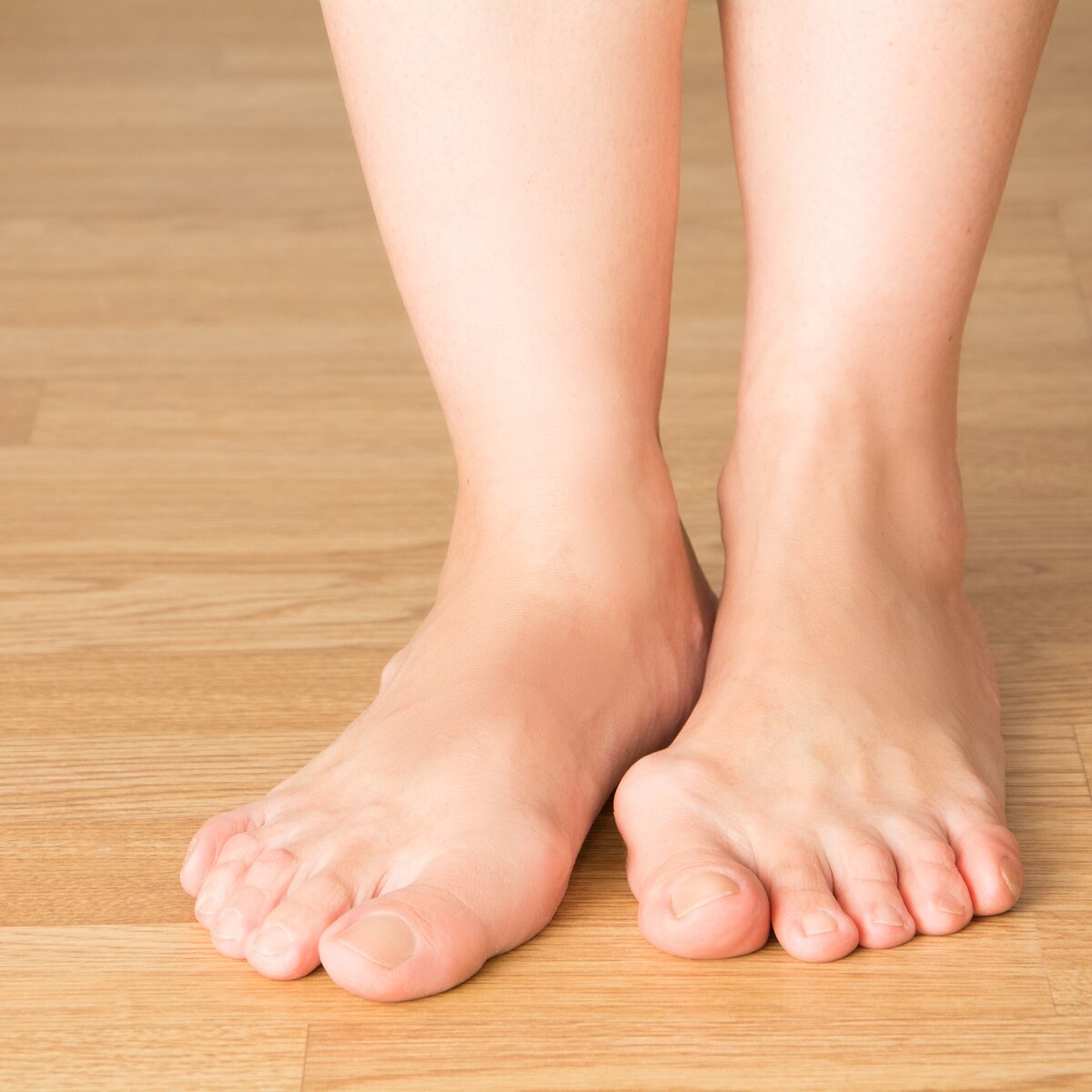 Как убрать шишку на ноге: эффективные методы лечения.