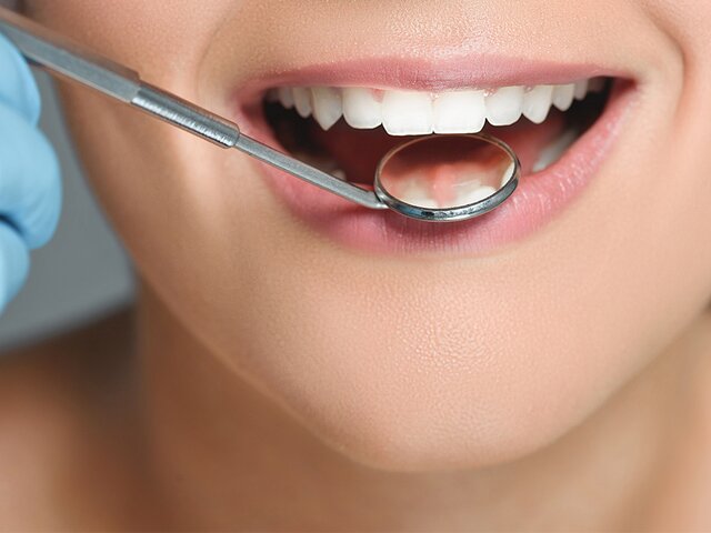 Стоматологи рассказали, какие продукты портят зубную эмаль