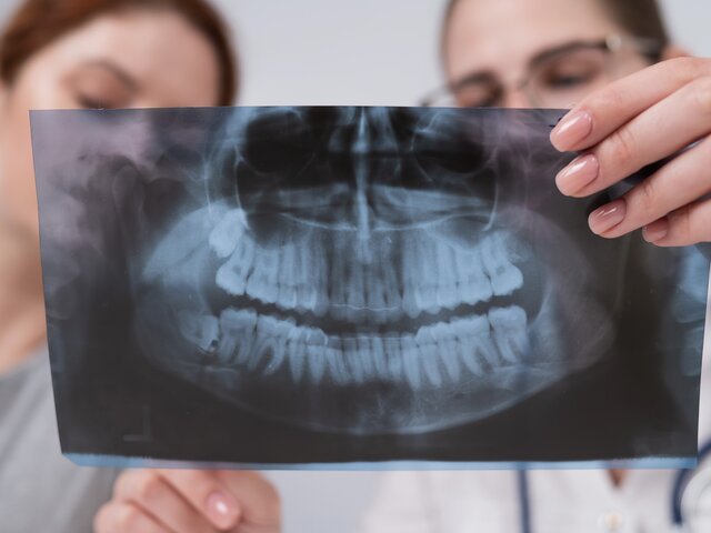 Стоматолог рассказала, кому противопоказана установка зубных имплантов