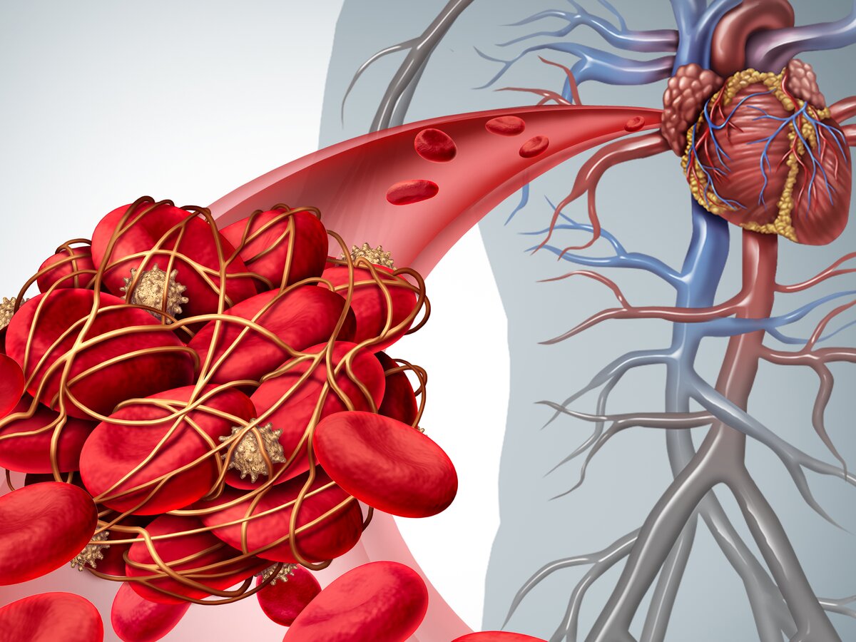 Врач предупредила об опасных последствиях тромбоза – Москва 24, 12.01.2024